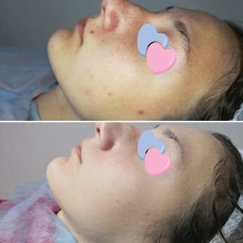 Анна , Львів Фото - 2