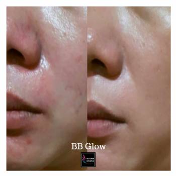 B7B Glow Treatment - Эффект тонального крема (Ровный тон и с