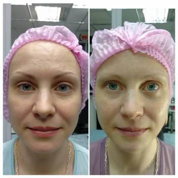 Гризли, Харьков Фото - 73