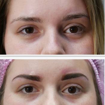 Гризли, Харьков Фото - 61