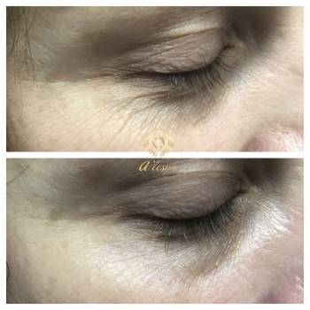 Алеся Серебрянская , Одеса Фото - 6