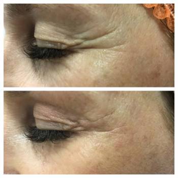 Алеся Серебрянская , Одеса Фото - 1