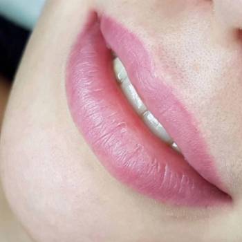 Заживший ПМ губ перед назначеной коррекцией