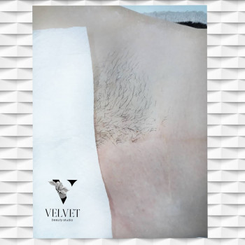 Стоимость 170 грн. Глубокое женское бикини. Фото "В процессе