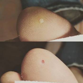 Легка хода, Івано-Франківськ Фото - 5