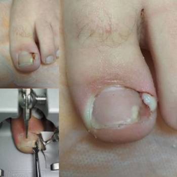 Легка хода, Івано-Франківськ Фото - 6