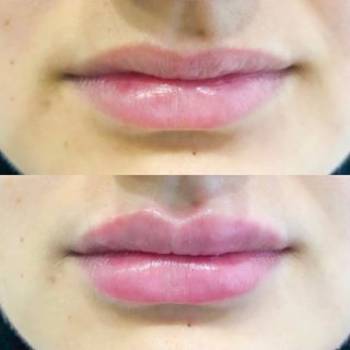 Екатерина Катеринич , Кропивницький Фото - 5