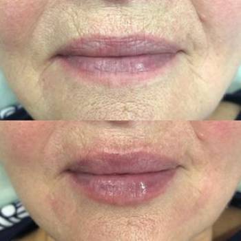 Екатерина Катеринич , Кропивницький Фото - 6