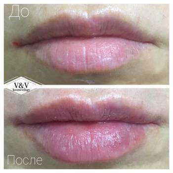 Фото из портфолио косметолога Оксана Вирская (Запорожье)