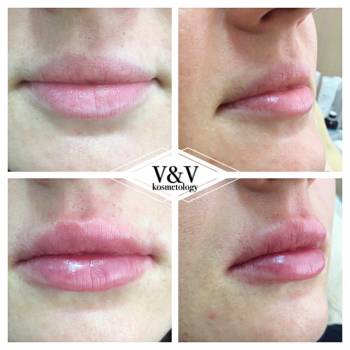 Фото из портфолио косметолога Оксана Вирская (Запорожье)