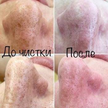 Дарья Чечотенко , Кропивницкий Фото - 6