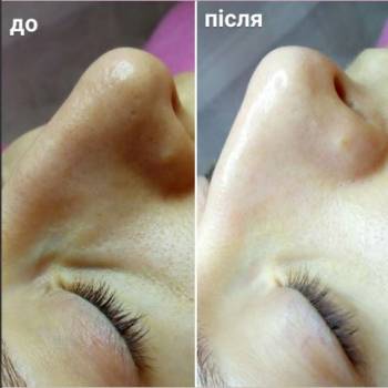 Ирина Васина , Кривий Ріг Фото - 3