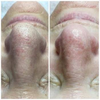 Фото с портфолио Элина 