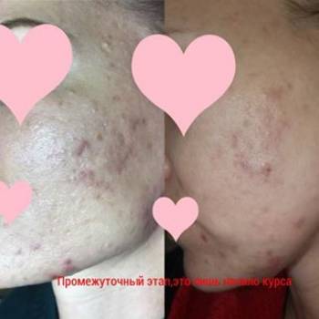 Марина Велитницкая, Кропивницкий Фото - 14