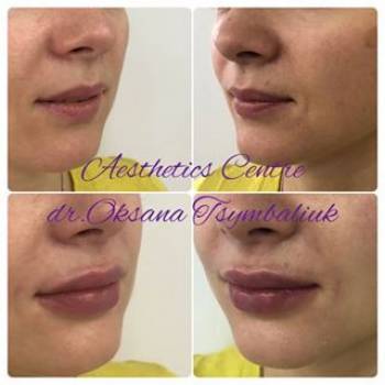 Эстетический центр Оксаны Цымбалюк, Киев Фото - 5