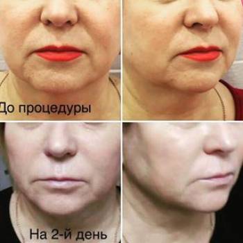 Эстетический центр Оксаны Цымбалюк, Киев Фото - 6