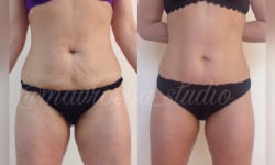 Медовый Массаж Массажист Татьяна Мавродиева Николаев