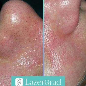 LazerGrad, Киев Фото - 5