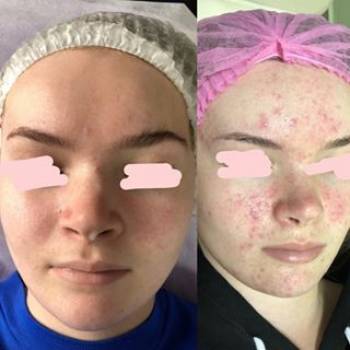 Face&Body SPA, Тернопіль Фото - 5