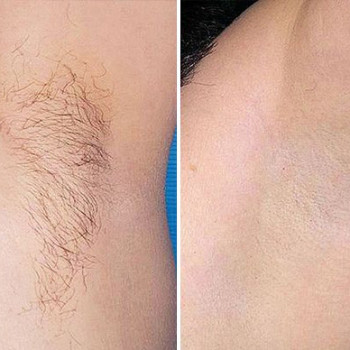 Фото с портфолио Оля 