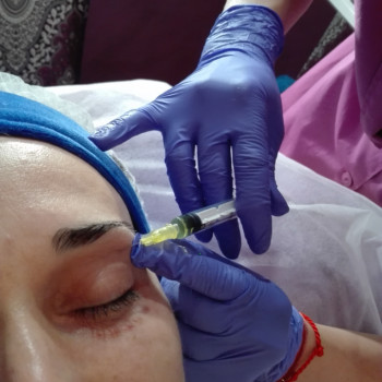 Инъекционное омоложение кожи в Киеве
                    Косметологічний центр ASA LASER COSMETIC Київ