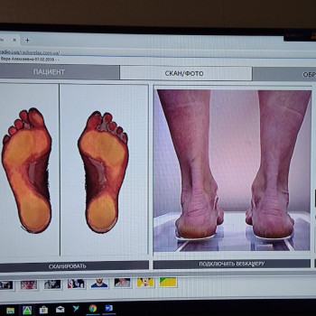 Фото с портфолио Профілвнд