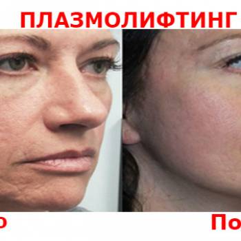 Людмила Васильева , Днепр Фото - 6