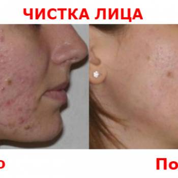 Людмила Васильева , Днепр Фото - 7