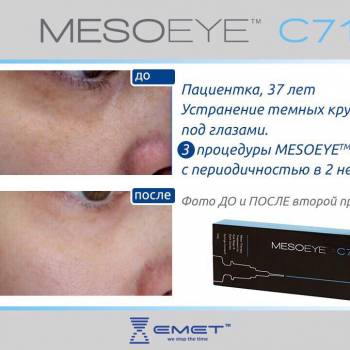 Инъекционный препарат эффективно устраняющий эстетические пр