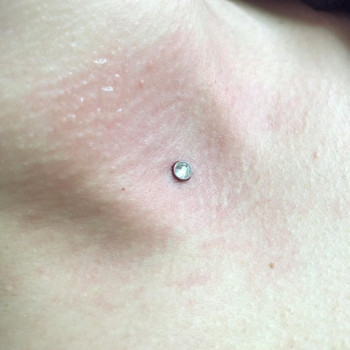 Микродермал
                    Майстер з пірсингу Тина Одеса