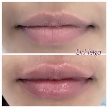 LASERGOOD, Ужгород Фото - 5