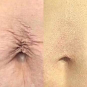 LASERGOOD, Ужгород Фото - 6