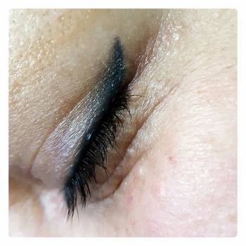 Стрелочка зажившая