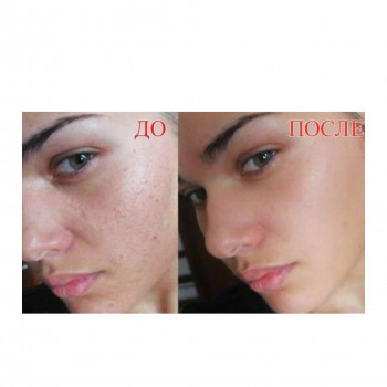 Bb glow, фото - косметолог Юлия Аскерова