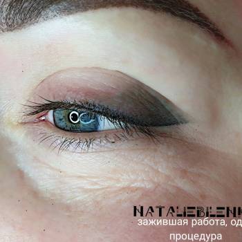 Зажившие веки через две недели