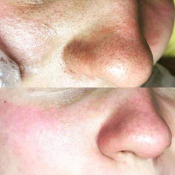 Анна , Одесса Фото - 6