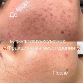 Виктория Климчук , Белая Церковь Фото - 5