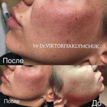 Виктория Климчук , Белая Церковь Фото - 6