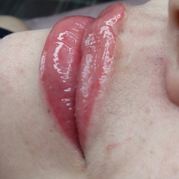 Акварельная техника. Фото без фильтра. После заживления буде