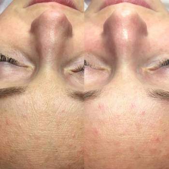 Елена Алова, Херсон Фото - 12