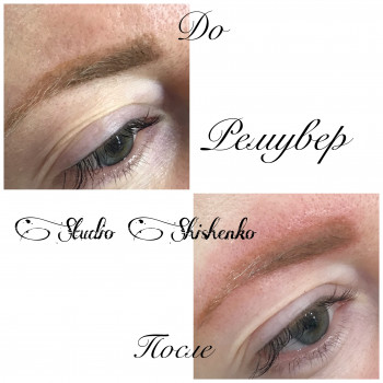 Лазерное Удаление некачественного татуажа
                    Салон краси Studio Shishenko Дніпро