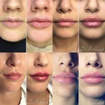 Celebrity, Біла Церква Фото - 5