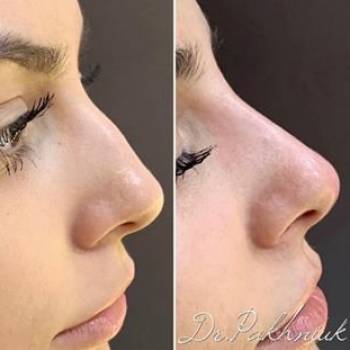 Celebrity, Біла Церква Фото - 6