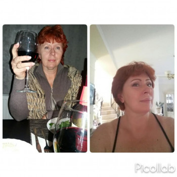   
До и через 3 месяца 
57 лет