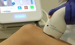 Лазерная эпиляция голеней Косметологический центр Body House Харьков