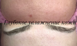 Глубокое увлажнение кожи Косметолог Дарья Тиодорова Дніпро