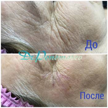 "Гусиные Лапки"