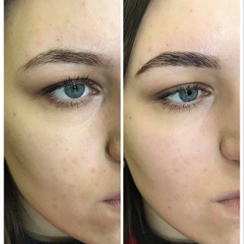 Долговременная укладка бровей
                    Салон красоты GOODLASHES Киев