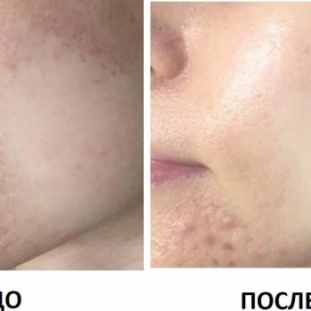 Лариса , Одеса Фото - 9