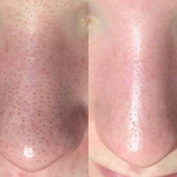 Дарья Рублева, Одеса Фото - 46